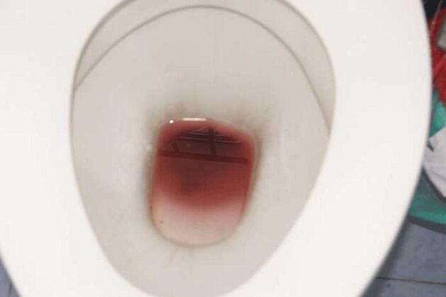 spotting sa mga lalaki kung excited